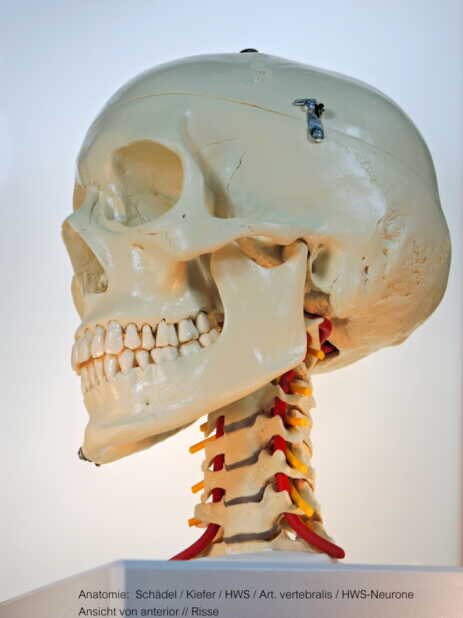Schädel Foto: Dr. Risse Anatomie: Schädel / Kiefer / HWS / Art. Vertebralis HWS-Neurone / Ansicht von anterior - Dr. Risse