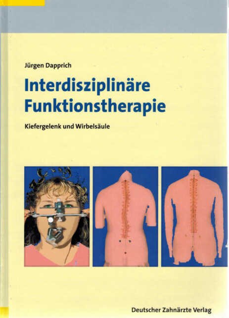 J. Dapprich, Interdisziplinäre Funktionstherapie, Deutscher Zahnärzteverlag 2016 J. Dapprich, Interdisziplinäre Funktionstherapie, Deutscher Zahnärzteverlag 2016